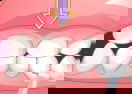 Bad Teeth Makeover